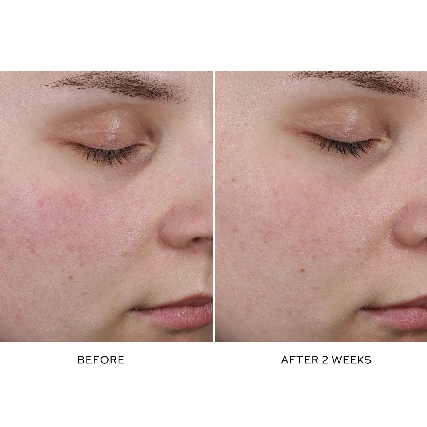 Pore Refining Complex