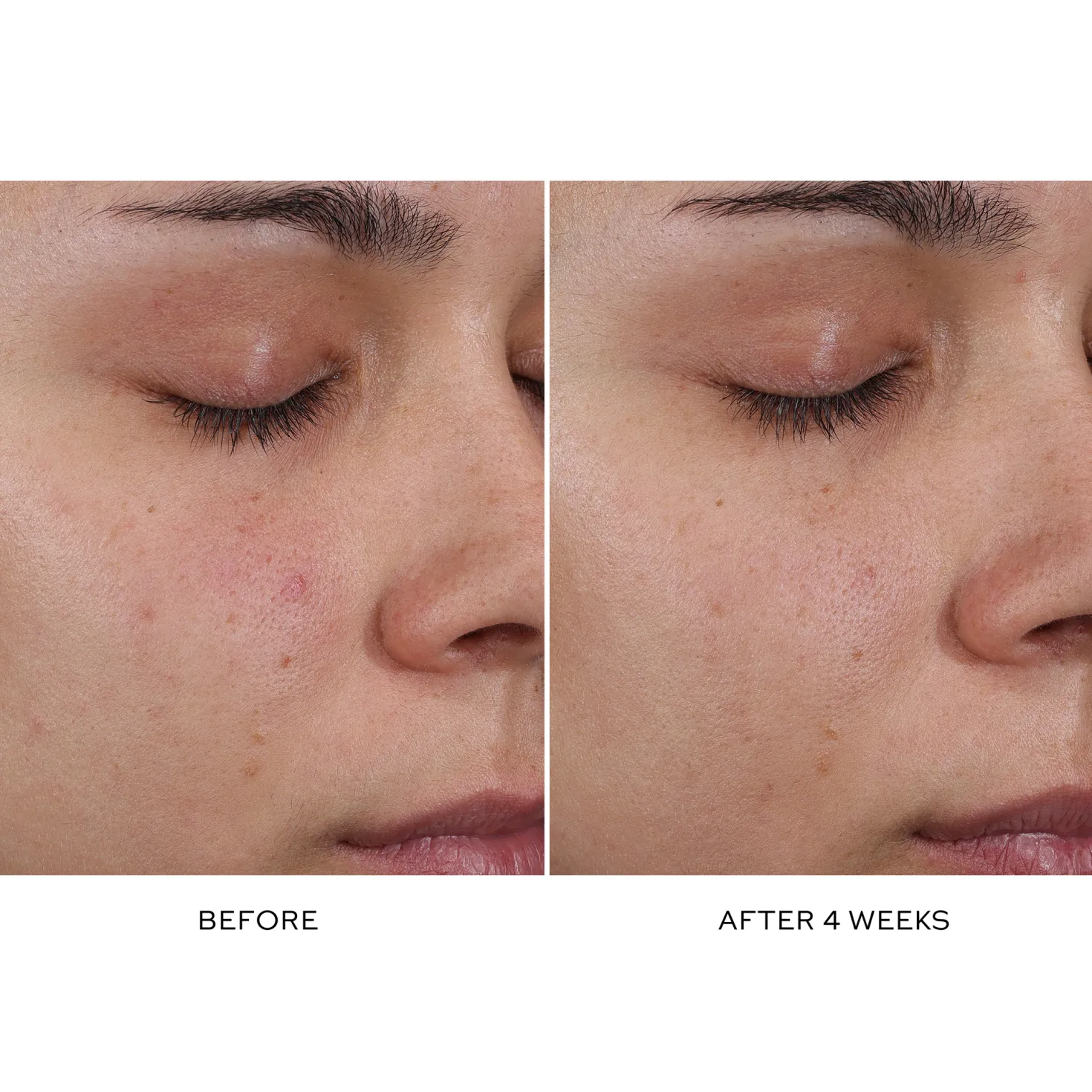 Pore Refining Complex