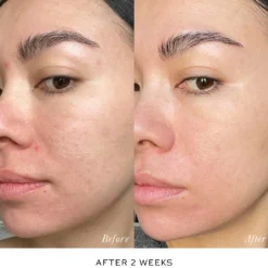 Skin Activator