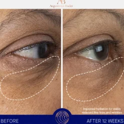 The Eye Cream Nomad