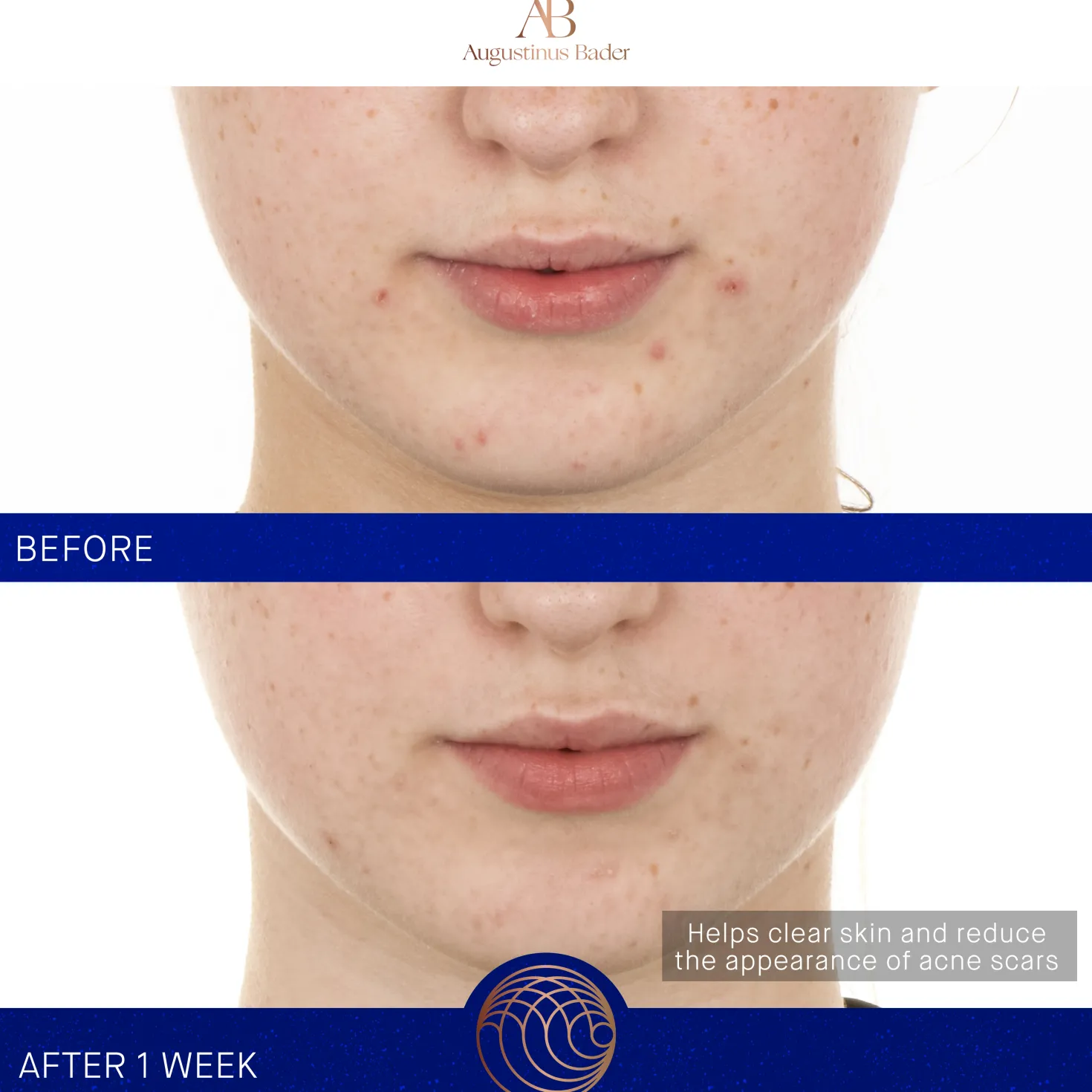 The Retinol Serum