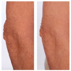 The Sculpt Arm Compound