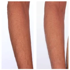 The Sculpt Arm Compound