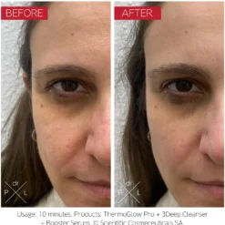 The Thermo Glow Pro