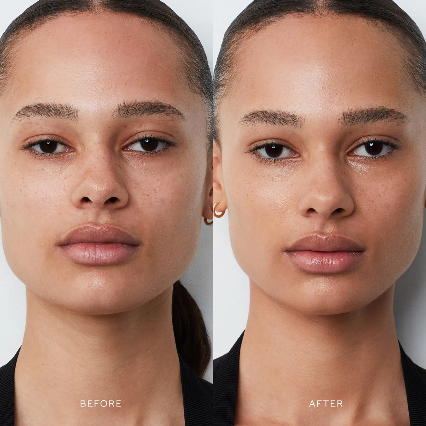 Vital Skincare Complexion Drops V
