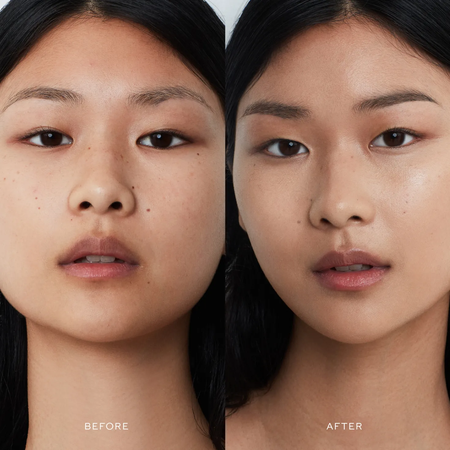 Vital Skincare Complexion Drops II