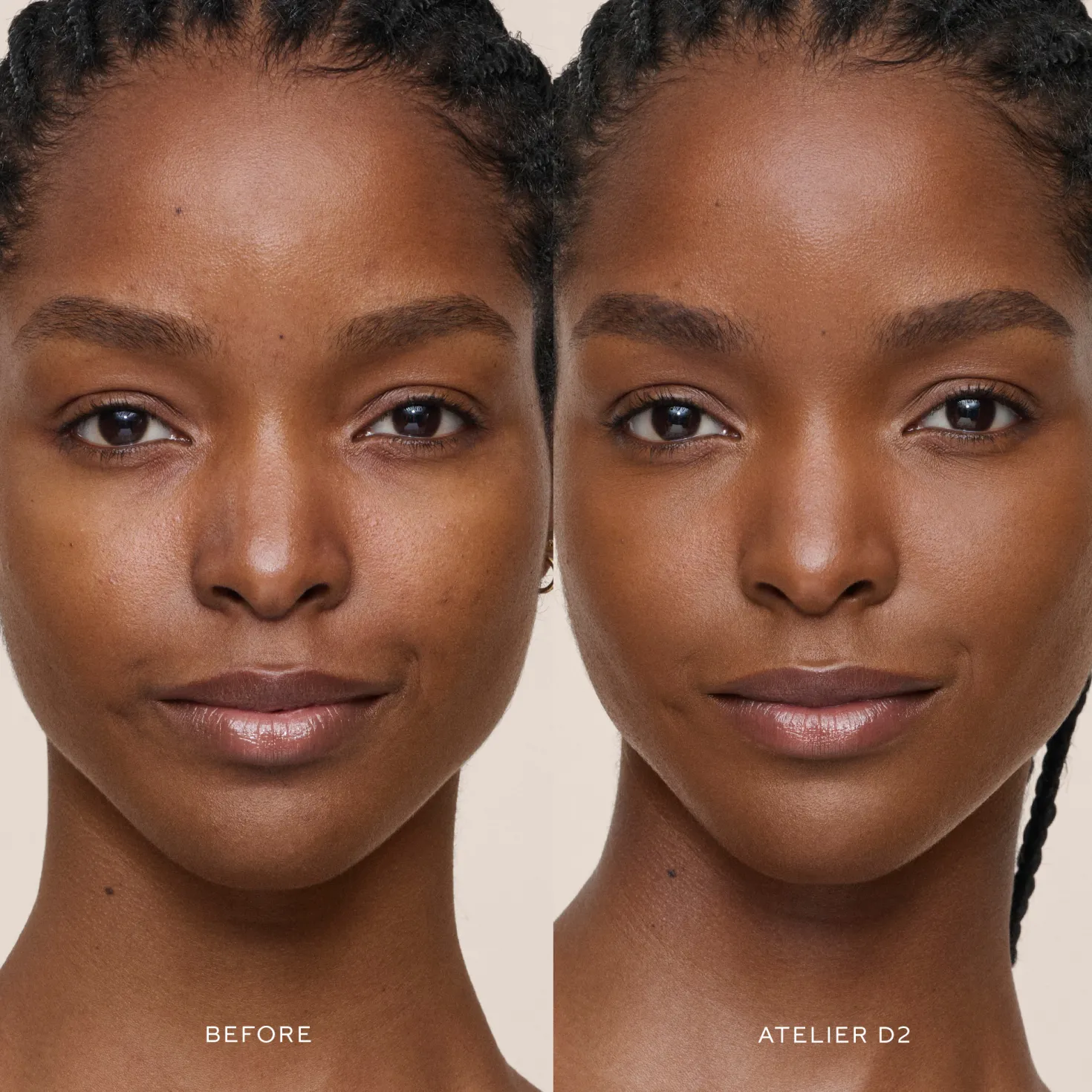 Vital Skincare Concealer D2